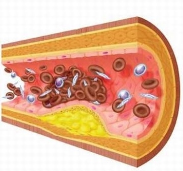 Содержание железа в вакуолях клеток